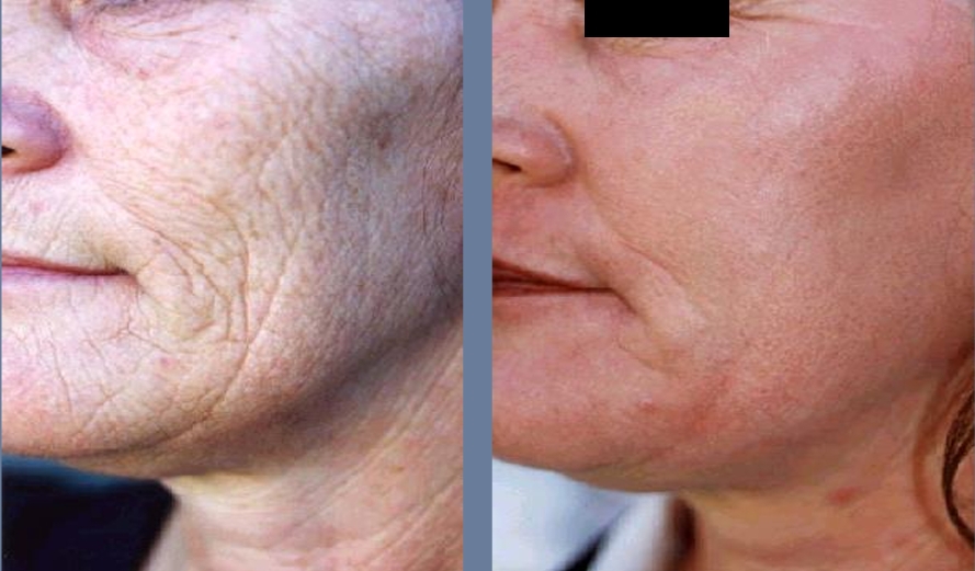 Beauty Planet NeoGen